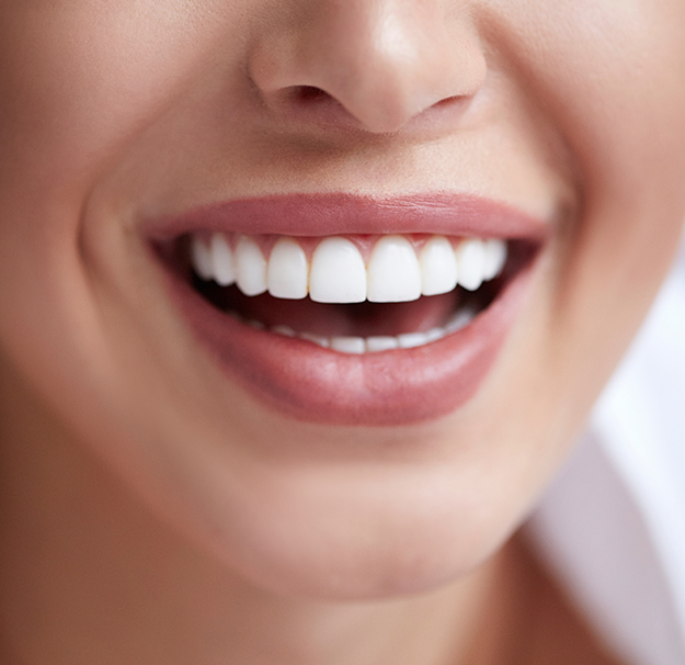 Dentisterie esthétique - Blanchiment dentaire - Blanchiment des dents - Clinique de santé dentaire Tammy Raymond